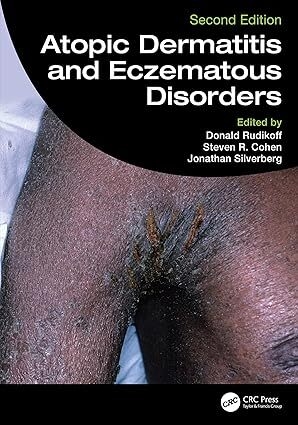 عکس Atopic Dermatitis and Eczematous Disorders
